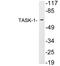 Potassium Two Pore Domain Channel Subfamily K Member 3 antibody, LS-C200019, Lifespan Biosciences, Western Blot image 