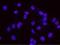RAN Binding Protein 3 antibody, NB100-74647, Novus Biologicals, Proximity Ligation Assay image 