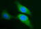 Sphingosine Kinase 1 antibody, M01390-1, Boster Biological Technology, Immunofluorescence image 