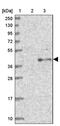 Tectonic Family Member 1 antibody, PA5-59037, Invitrogen Antibodies, Western Blot image 