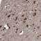 Pro-Apoptotic WT1 Regulator antibody, NBP1-87338, Novus Biologicals, Immunohistochemistry frozen image 