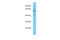 Inositol Polyphosphate Multikinase antibody, ARP65580_P050, Aviva Systems Biology, Western Blot image 