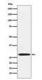 Mitochondrial Ribosomal Protein L28 antibody, M12699, Boster Biological Technology, Western Blot image 