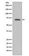 Raf-1 Proto-Oncogene, Serine/Threonine Kinase antibody, M00446-1, Boster Biological Technology, Western Blot image 