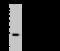 Collagenase inhibitor antibody, 106164-T40, Sino Biological, Western Blot image 