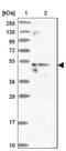McKusick-Kaufman Syndrome antibody, NBP1-92122, Novus Biologicals, Western Blot image 