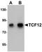 Transcription Factor 12 antibody, orb75504, Biorbyt, Western Blot image 