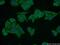 S100 Calcium Binding Protein A5 antibody, 17924-1-AP, Proteintech Group, Immunofluorescence image 