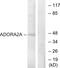 Adenosine A2a Receptor antibody, LS-C120623, Lifespan Biosciences, Western Blot image 