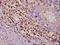 Protein Kinase C Delta antibody, A00822-2, Boster Biological Technology, Immunohistochemistry paraffin image 