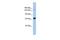 Kinesin Family Member 15 antibody, GTX47727, GeneTex, Western Blot image 