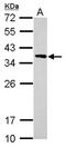 Calponin 2 antibody, NBP2-15679, Novus Biologicals, Western Blot image 