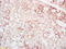 CXADR Like Membrane Protein antibody, GTX51678, GeneTex, Immunohistochemistry paraffin image 