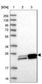 Guanylate kinase antibody, NBP2-14078, Novus Biologicals, Western Blot image 