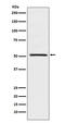 Nuclear Receptor Subfamily 0 Group B Member 1 antibody, M01521, Boster Biological Technology, Western Blot image 