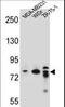 Rho GTPase-activating protein 22 antibody, LS-C156469, Lifespan Biosciences, Western Blot image 