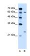 RAR Related Orphan Receptor A antibody, orb330424, Biorbyt, Western Blot image 