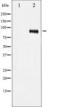 Insulin Like Growth Factor 1 Receptor antibody, TA325552, Origene, Western Blot image 