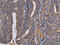 Regenerating Family Member 3 Gamma antibody, CSB-PA074697, Cusabio, Immunohistochemistry paraffin image 