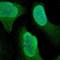 Ribosomal Protein S6 Kinase A3 antibody, NBP1-85552, Novus Biologicals, Immunocytochemistry image 