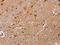 Fructose-Bisphosphatase 2 antibody, orb520829, Biorbyt, Immunohistochemistry paraffin image 