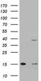 Translocase Of Outer Mitochondrial Membrane 40 Like antibody, TA810663, Origene, Western Blot image 