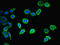 Centrosomal protein of 83 kDa antibody, LS-C682096, Lifespan Biosciences, Immunofluorescence image 