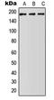 ATP Binding Cassette Subfamily A Member 5 antibody, GTX54891, GeneTex, Western Blot image 