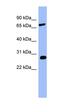 Catechol-O-Methyltransferase antibody, orb330382, Biorbyt, Western Blot image 