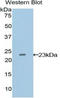 Vascular Endothelial Growth Factor B antibody, LS-C302689, Lifespan Biosciences, Western Blot image 