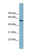 Phosphoglucomutase 3 antibody, orb330891, Biorbyt, Western Blot image 