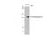 Thrombospondin 2 antibody, GTX636506, GeneTex, Western Blot image 