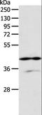 Adenosine Deaminase antibody, LS-C404443, Lifespan Biosciences, Western Blot image 