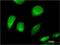 Chloride Voltage-Gated Channel 6 antibody, H00001185-M05, Novus Biologicals, Immunocytochemistry image 