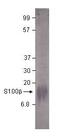 S100 Calcium Binding Protein B antibody, PA1-31162, Invitrogen Antibodies, Western Blot image 