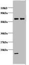 Cytochrome C Oxidase Subunit 5B antibody, A51597-100, Epigentek, Western Blot image 