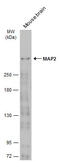 MAP2 antibody, GTX133109, GeneTex, Western Blot image 