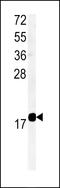 Transmembrane Protein 222 antibody, 61-803, ProSci, Western Blot image 