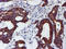 Myocyte Enhancer Factor 2C antibody, LS-C785749, Lifespan Biosciences, Immunohistochemistry paraffin image 