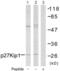 Cyclin Dependent Kinase Inhibitor 1B antibody, LS-C118204, Lifespan Biosciences, Western Blot image 