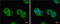 Anti-Mullerian Hormone antibody, GTX129593, GeneTex, Immunofluorescence image 