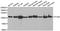 Glycogen Phosphorylase B antibody, A6402, ABclonal Technology, Western Blot image 