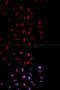 Proteasome Subunit Beta 1 antibody, A06891, Boster Biological Technology, Western Blot image 