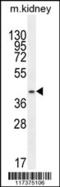 Proteasome 26S Subunit, Non-ATPase 11 antibody, 61-518, ProSci, Western Blot image 