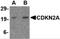 Cyclin-dependent kinase inhibitor 2A, isoforms 1/2/3 antibody, 4211, ProSci Inc, Western Blot image 