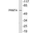 Coactivator Associated Arginine Methyltransferase 1 antibody, LS-C199979, Lifespan Biosciences, Western Blot image 