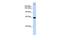 Trinucleotide repeat-containing gene 6A protein antibody, GTX47266, GeneTex, Western Blot image 