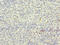 Cyclin Dependent Kinase Inhibitor 2D antibody, LS-C675495, Lifespan Biosciences, Immunohistochemistry paraffin image 