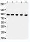 MCC Regulator Of WNT Signaling Pathway antibody, PA5-79643, Invitrogen Antibodies, Western Blot image 