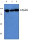 Aryl Hydrocarbon Receptor antibody, PA5-36025, Invitrogen Antibodies, Western Blot image 